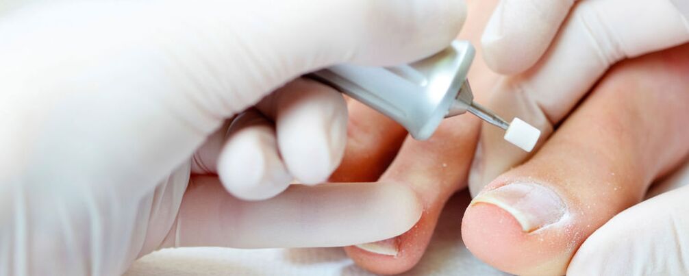 Coupez la couche d'ongle supérieure